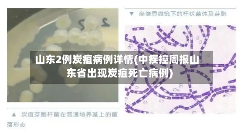 山东2例炭疽病例详情(中疾控周报山东省出现炭疽死亡病例)-第2张图片