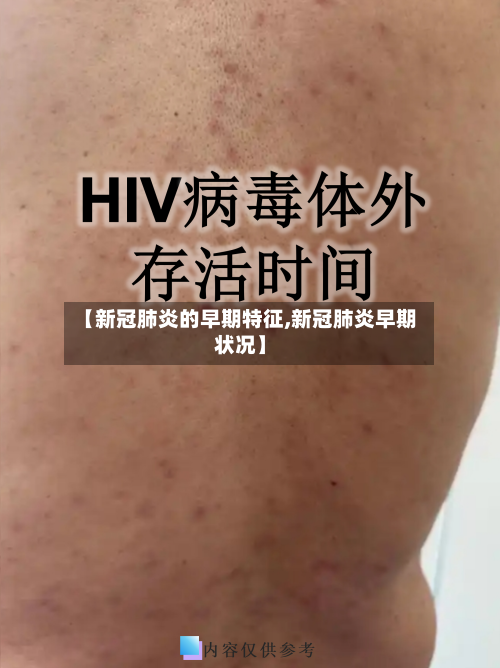 【新冠肺炎的早期特征,新冠肺炎早期状况】
