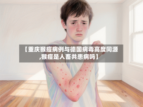 【重庆猴痘病例与德国病毒高度同源,猴痘是人畜共患病吗】
